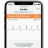 Портативный электрокардиограф AliveCor KardiaMobile EKG для iOS/Android (Black) оптом